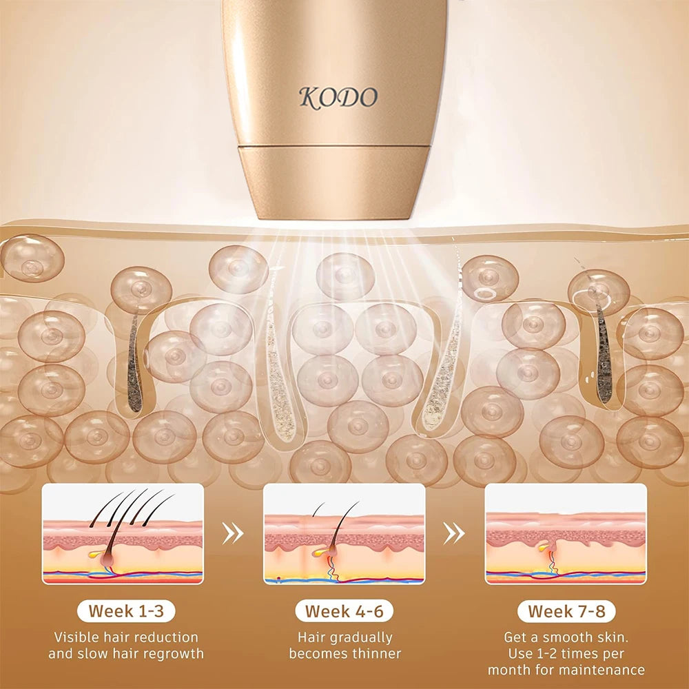 KODO 2026 High-end Customization Ice Laser Hair Removal Laser Epilator Permanent IPL Painless Photoepilator 4 in 1 Face and Body